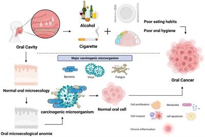 Insights into the oral microbiota in human systemic cancers